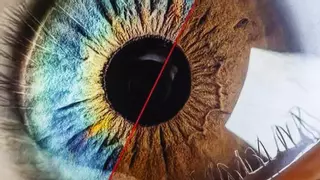 Una investigación internacional desde Alicante avala la seguridad de cambiar el color de ojos por estética
