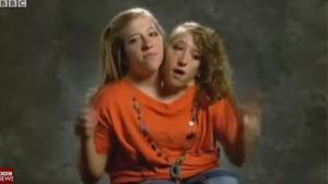 Documental de la BBC sobre dues siameses amb un mateix cos