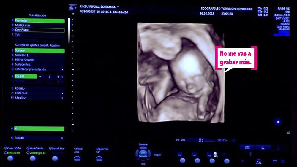 Ecografía de Verdeliss