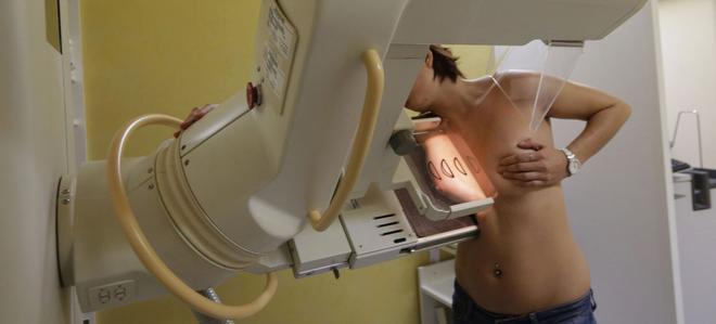 Les joves amb càncer de mama es poden sotmetre a tècniques de fertilitat