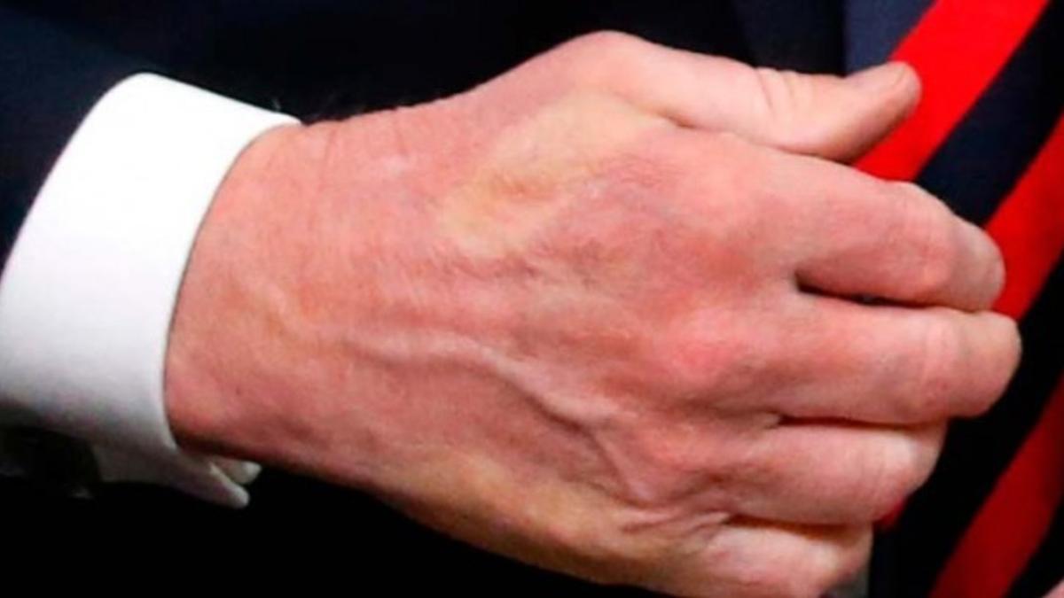 El dedo pulgar de Macron marcado en la mano deTrump tras el fuerte saludo de los mandatarios en el G-7.