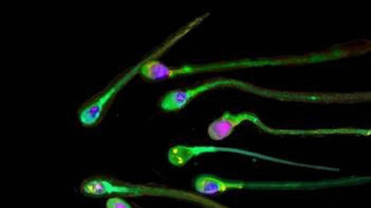 Fotografía de esperma humano difundida por la revista 'The Journal of Science'.