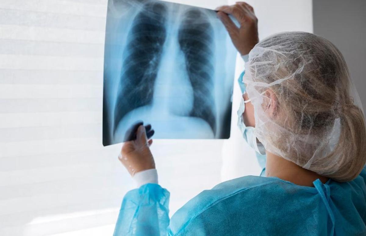 Mirar els pulmons per saber si hi ha MPOC