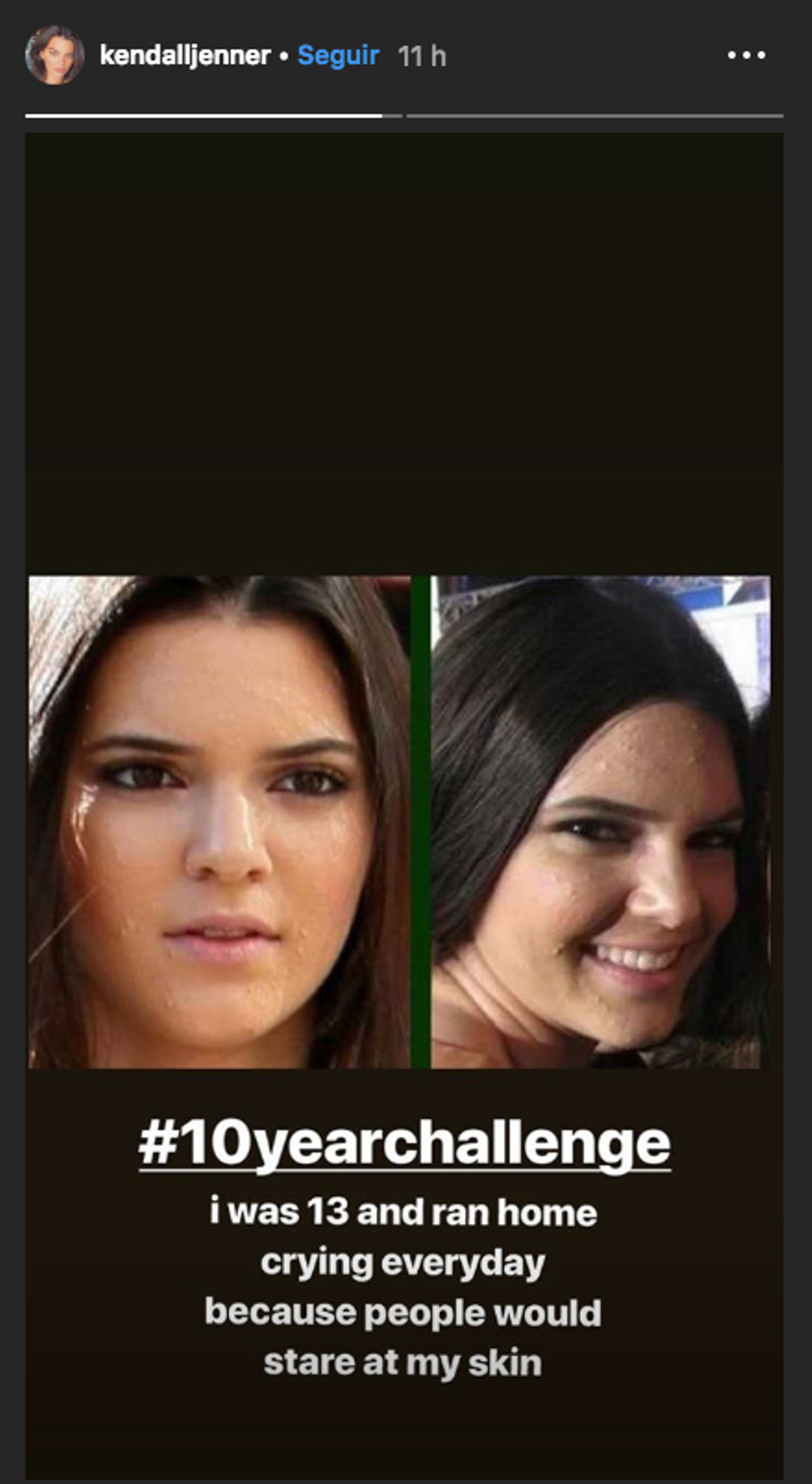 Kendall Jenner se une al #10yearchallenge en Instagram.