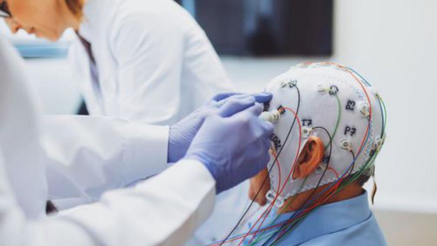 Logran detectar precozmente el alzhéimer a través del registro de la actividad cerebral