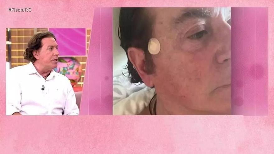 Pipi Estrada, preocupat per la seva salut després de sotmetre’s a una biòpsia: «Estic una mica acollonit»