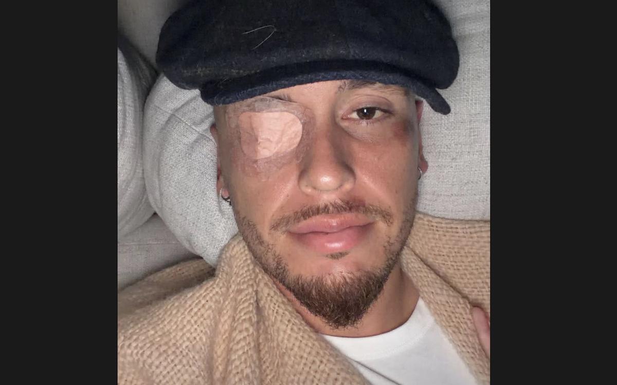 Lucas Ocampos sufre una parálisis facial