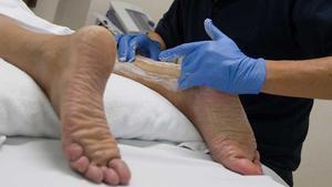 Un especialista trata el tendón de Aquiles de un paciente lesionado.