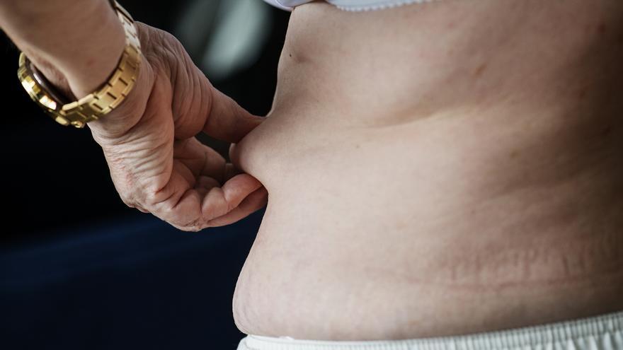 Mayor de 65 años y con obesidad abdominal (tripa) ¿Qué riesgo tiene y como se trata?