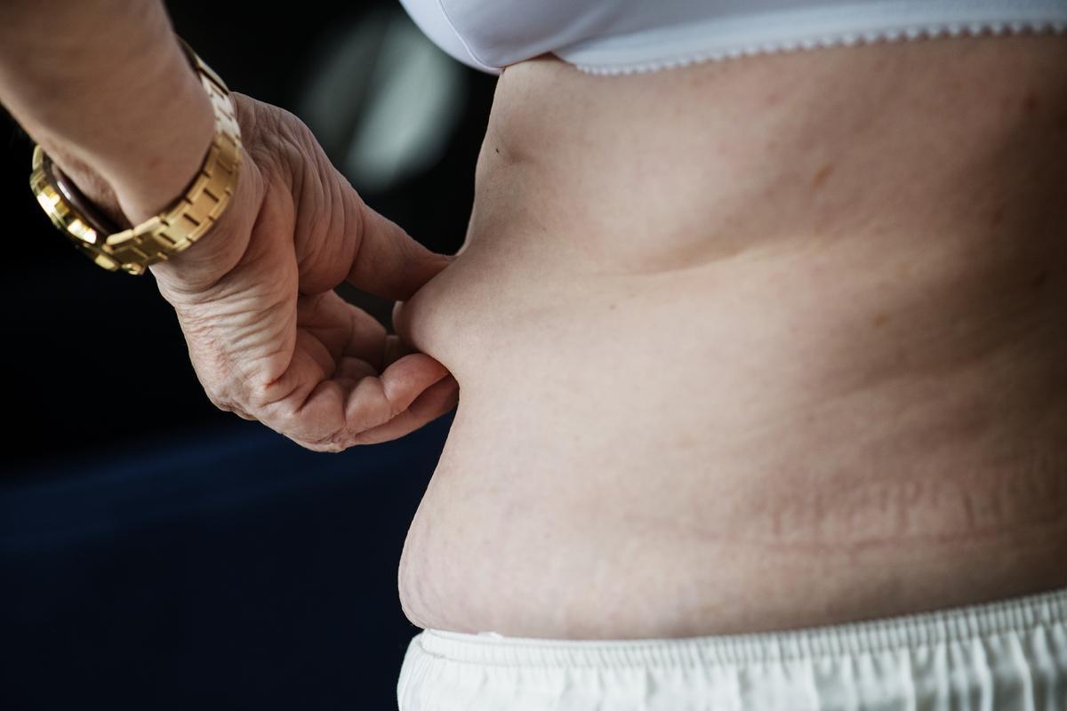 ¿Mayor de 65 años? Casi seguro, con obesidad abdominal: ¿Qué se puede hacer?