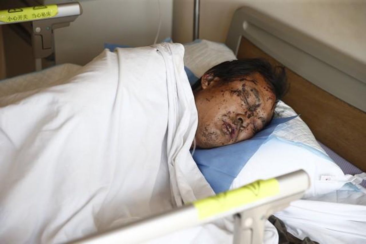 Una víctima d’una de les explosions, que han matat 50 persones, en un hospital de la ciutat de Tianjin.