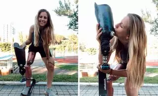 Desirée Vila desvela qué pasó con su pierna amputada
