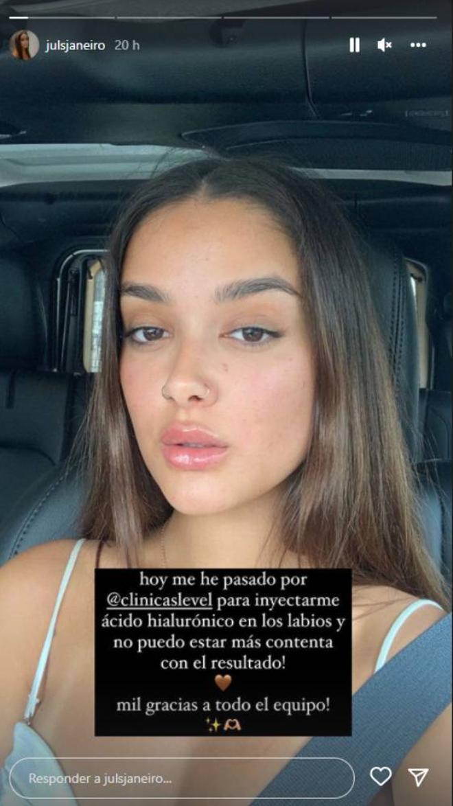 Julia Janeiro en los Instagram Stories enseñando sus labios retocados