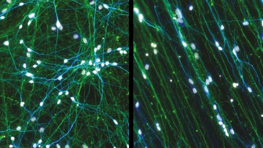 Científicos crean una "placa de circuito neuronal" que reproduce el cableado del cerebro humano a escala