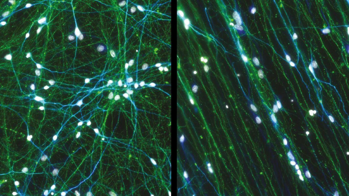 Izquierda: neuronas cultivadas en una placa sin los dispositivos poliméricos. Derecha: neuronas cultivadas en una placa con los dispositivos poliméricos ranurados desarrollados en el estudio.