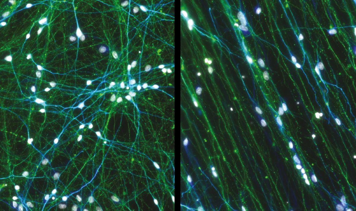 Izquierda: neuronas cultivadas en una placa sin los dispositivos poliméricos. Derecha: neuronas cultivadas en una placa con los dispositivos poliméricos ranurados desarrollados en el estudio.
