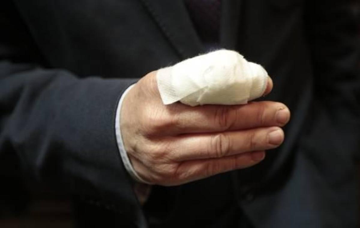 El marido de una edil perdió un dedo en la Cabalgata de Reyes