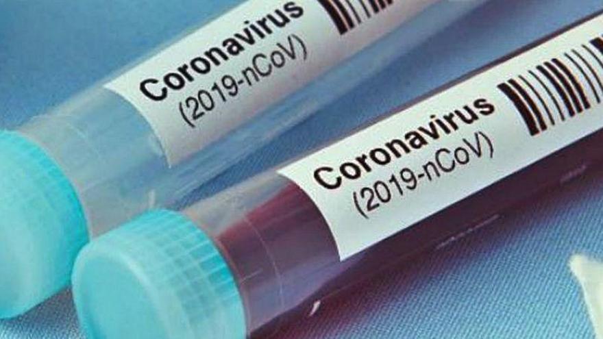 Ya se habla del precio que tendrá la vacuna contra el COVID-19