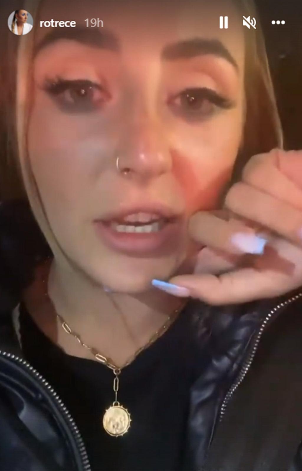 Rocío Flores tras someterse a tres retoques estéticos