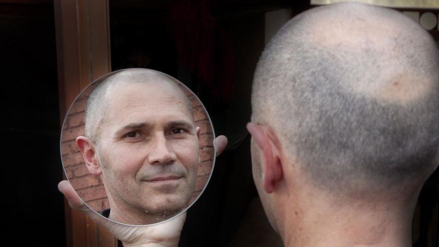 Shyness, the silent epidemic