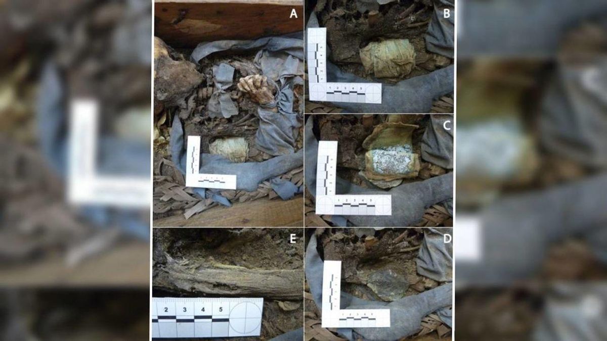 Una investigación de la Universidad Complutense de Madrid desvela cómo se trataba la enfermedad y el ritual funerario en el siglo XIX en Madrid