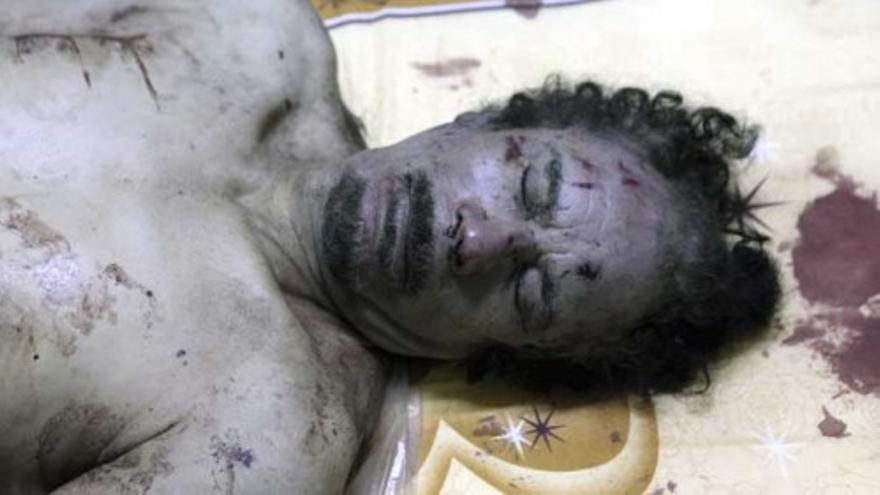 Nuevas imágenes de Gadafi, aturdido y ensangrentado