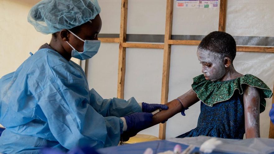 Enfermedad &quot;desconocida&quot; en el Congo con 70 muertos: lo que sabemos de la alerta de la OMS