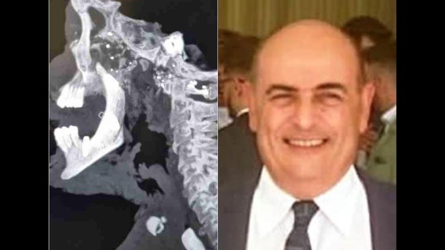 ¿Cómo mataron a Juan Miguel Isla? Piden exhumar el cadáver del empresario que fue asesinado y arrojado a un pozo