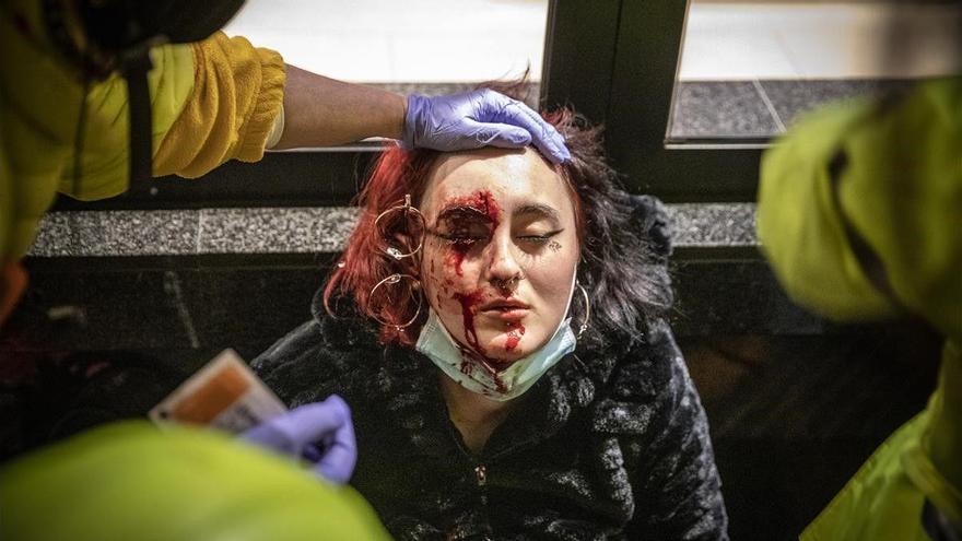 La mujer herida en Barcelona en la protesta por Hasél pierde el ojo