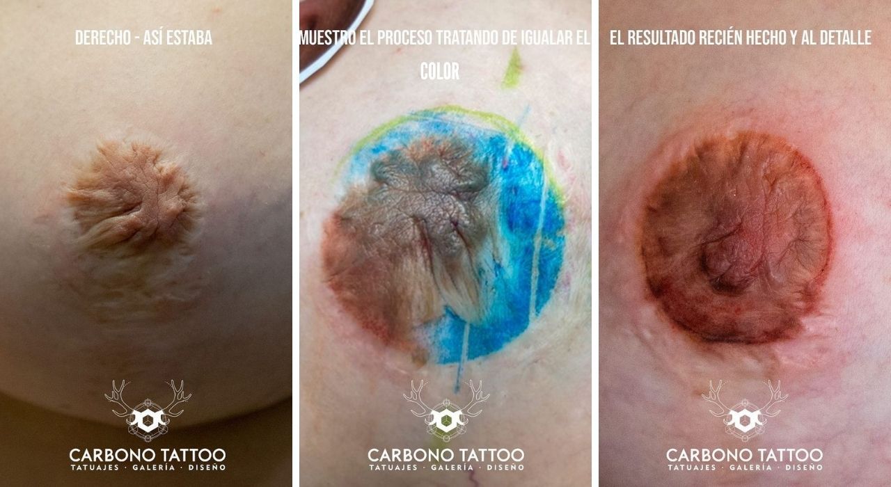 Proceso de un pezón atrofiado a uno tatuado, con varias capas de color de diferentes tonalidades.