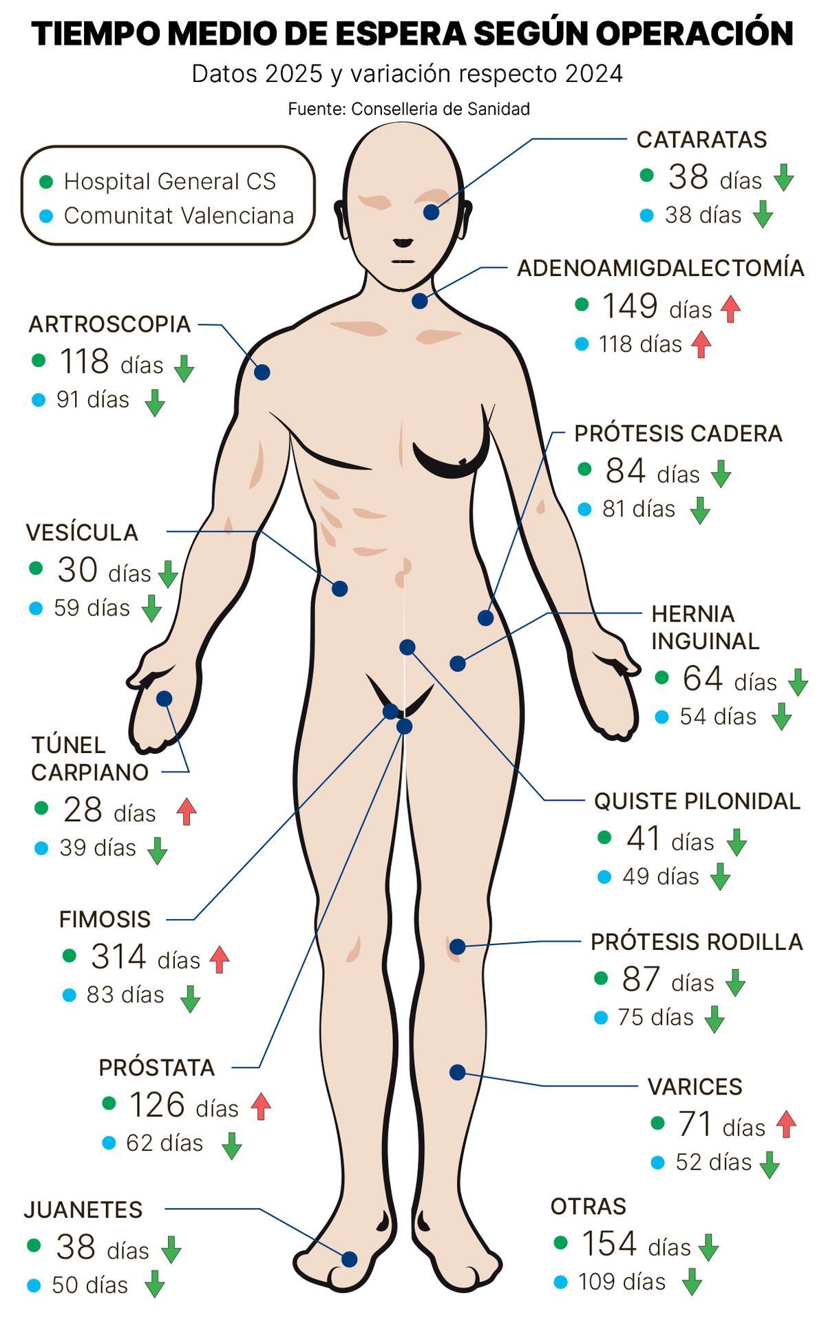 Tiempo media de espera para las operaciones.