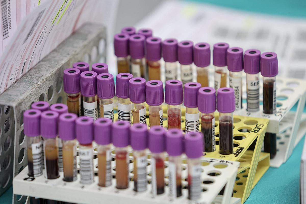 Avanza el protocolo de biomarcadores genéticos de Sanidad