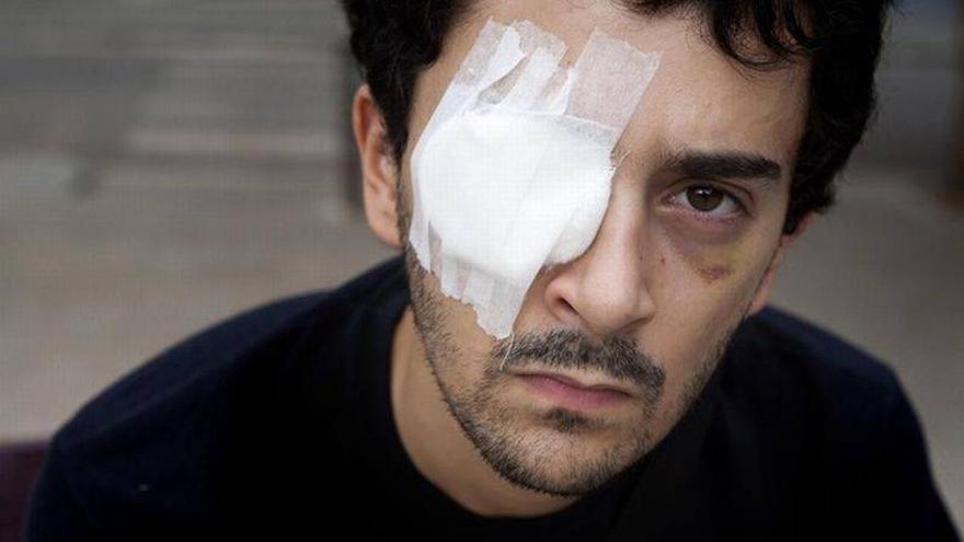 Imputados dos mossos en el caso de un joven que perdió un ojo