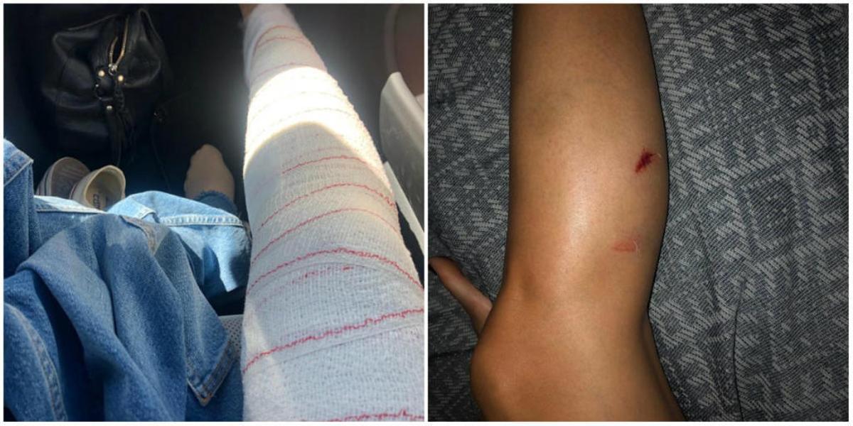 Un jabalí ataca a una joven en el parque natural del Túria