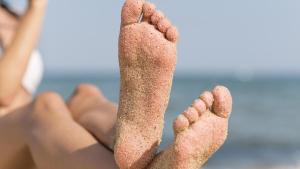 La enfermedad que está detrás del exceso de sudoración en los pies y puede causar infecciones