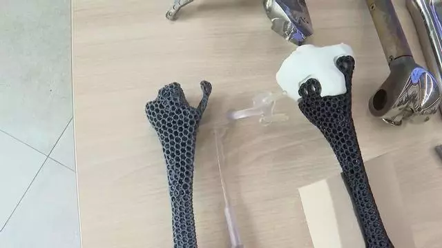 Así es la primera prótesis ósea personalizada de metamaterial del mundo, diseñada en el Hospital Gregorio Marañón de Madrid