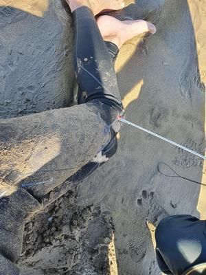 Se clava un arpón en una pierna en Puerto del Carmen