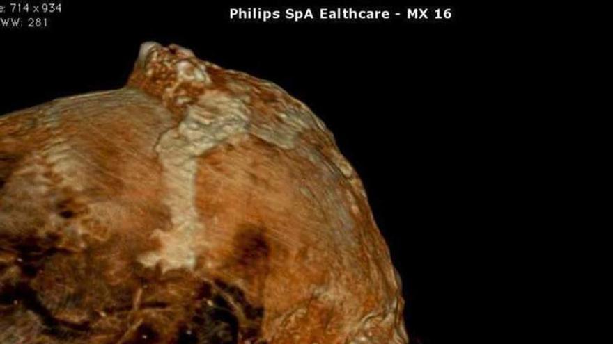 Tomografía axial computerizada de una momia.