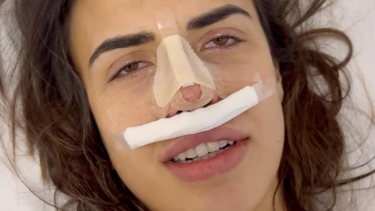 Sofía Suescun enseña su nueva nariz tras someterse a una rinoplastia: "¡Me encanta!"