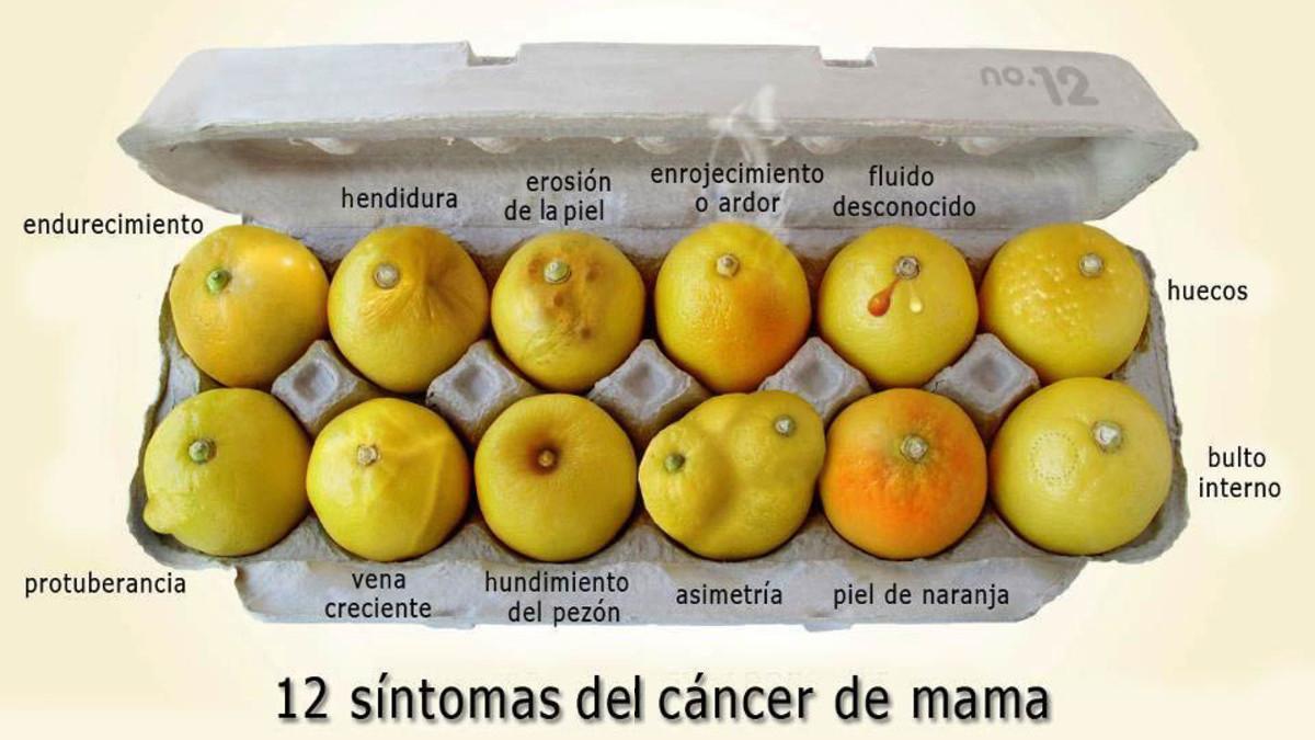 Limones para identificar distintos tipos de cáncer de mama