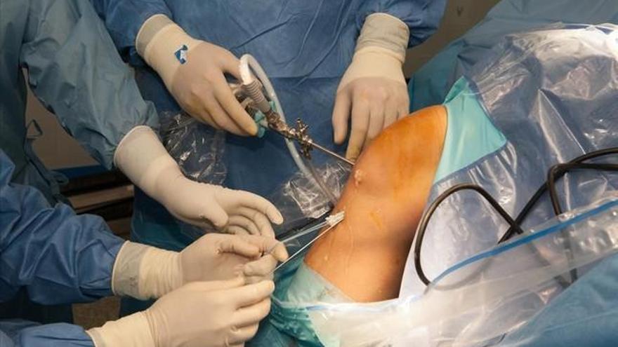 Una nueva cirugía usa tejido porcino para tratar la rotura de ligamentos