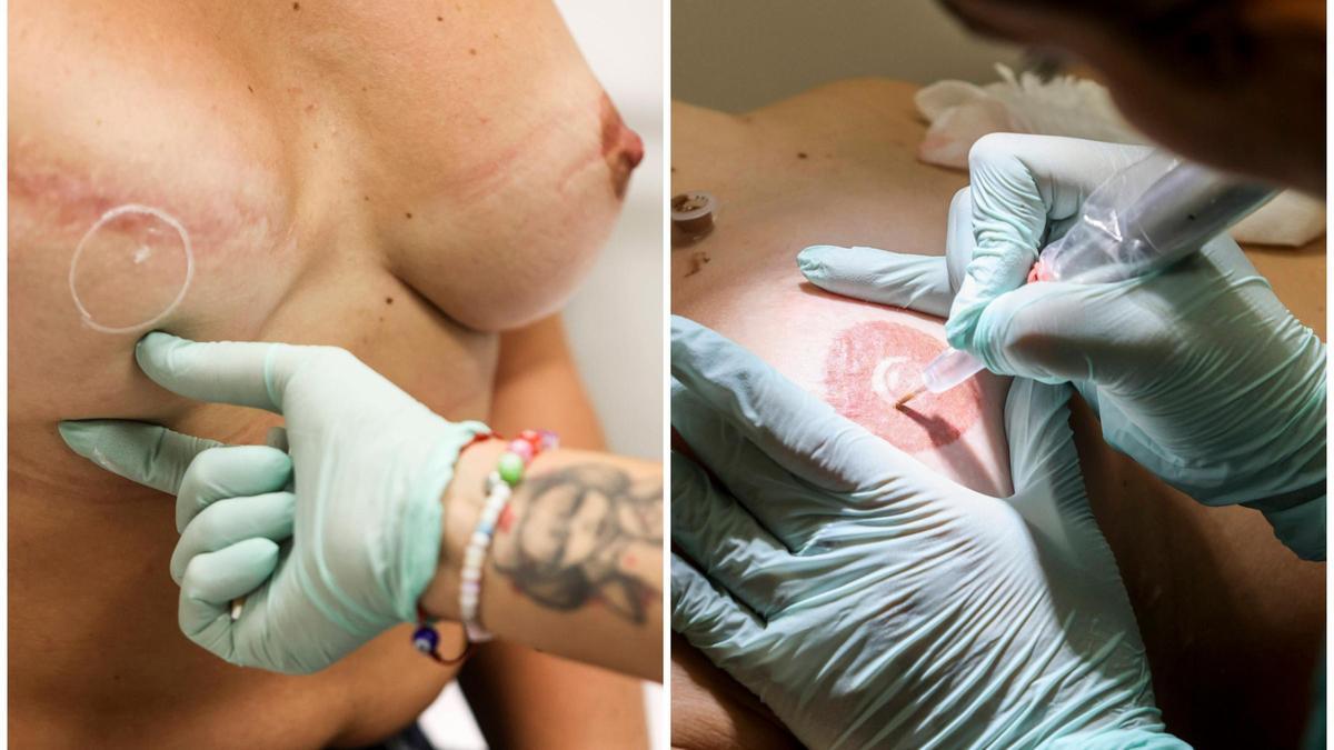 Patri completa la reconstrucción del pecho que perdió por culpa del cáncer "tatuándose" el pezón en La Fe.