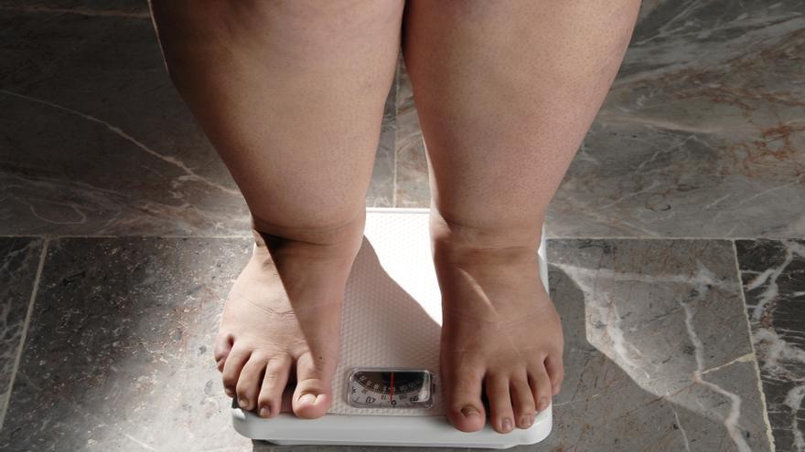 Tratamiento de obesidad: ¿Es adecuado realizarse una cirugía bariátrica en verano?