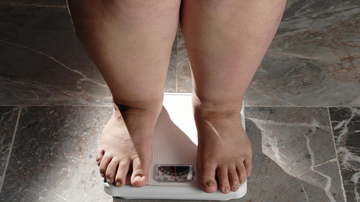 El tratamiento de la obesidad requiere un enfoque multidisciplinar