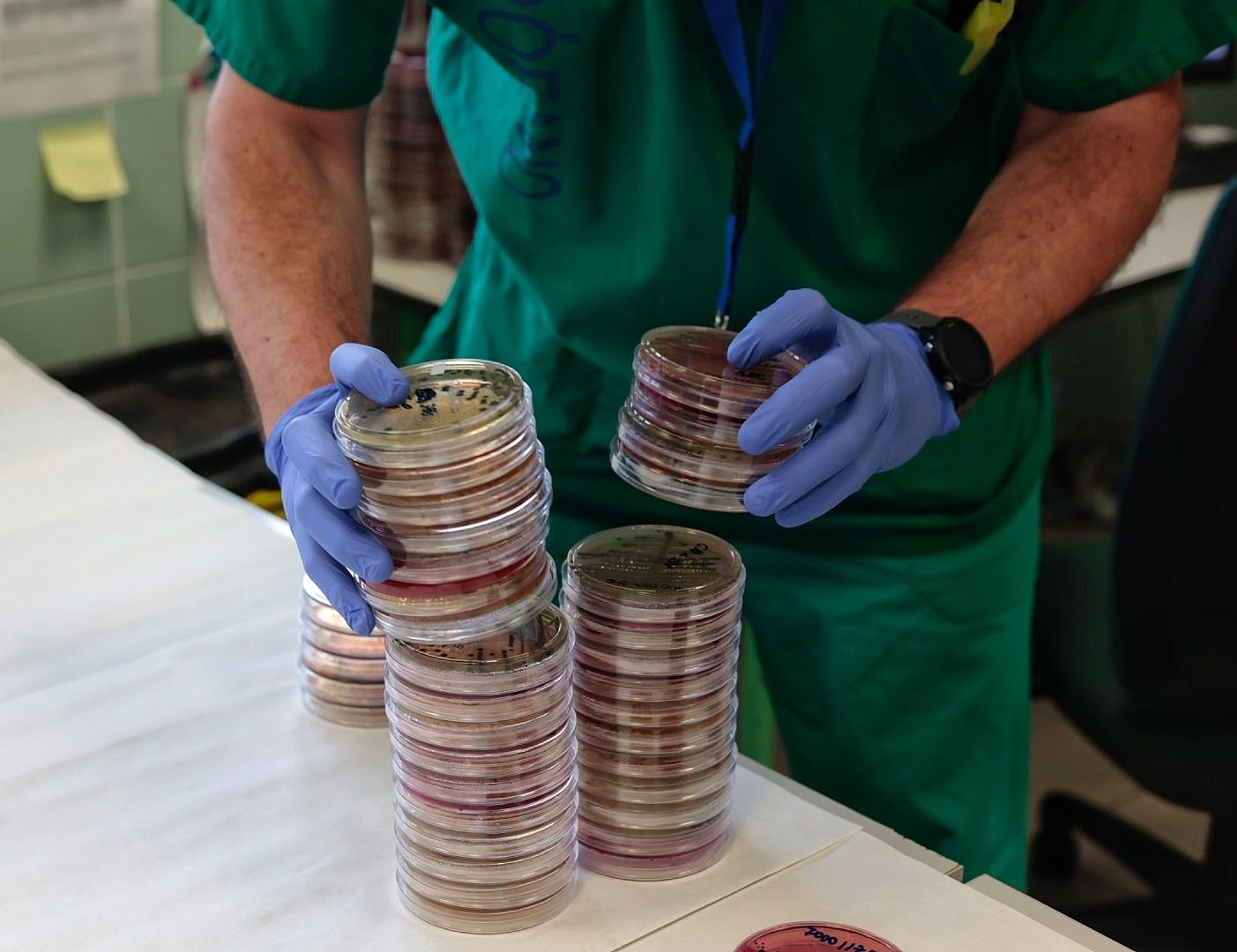 El área de microbiología del Hospital de La Candelaria es referente en detección de bacterias multirresistentes.