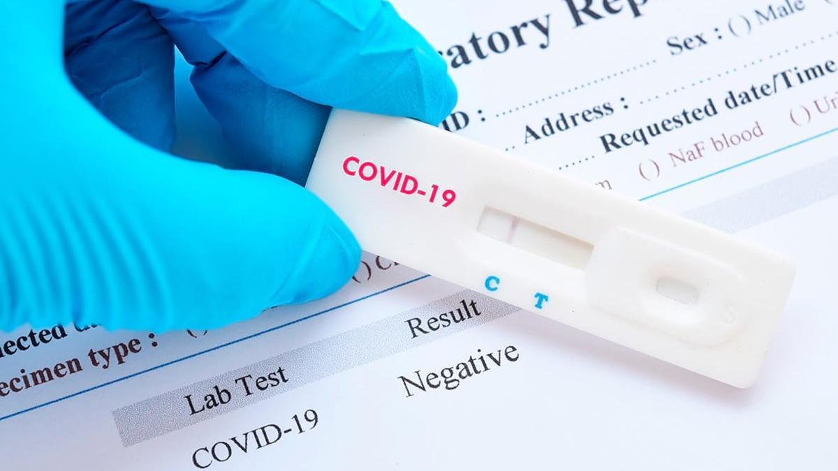 Test de detección rápida del coronavirus