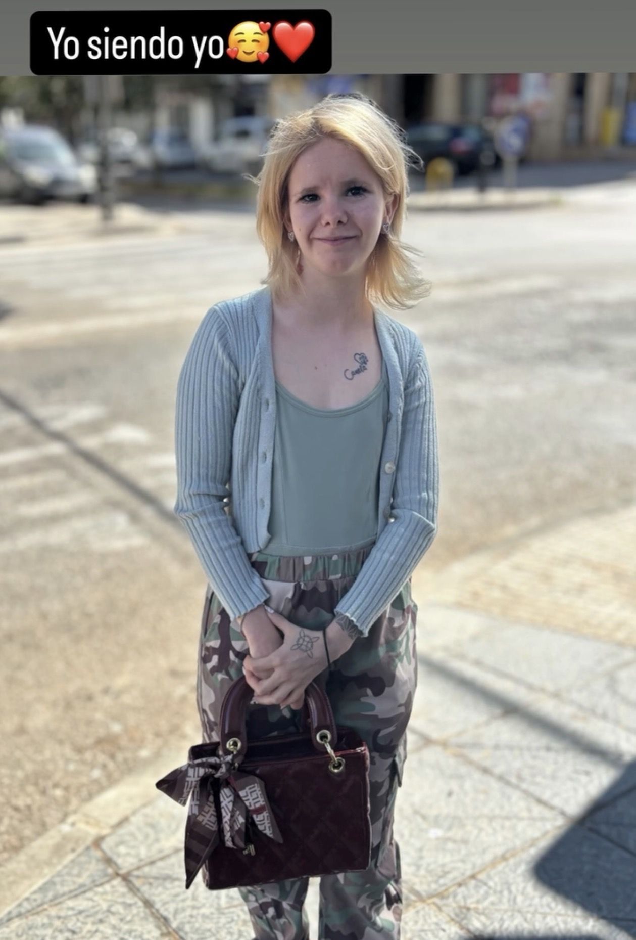 Ruth padece el síndrome de Russell-Silver