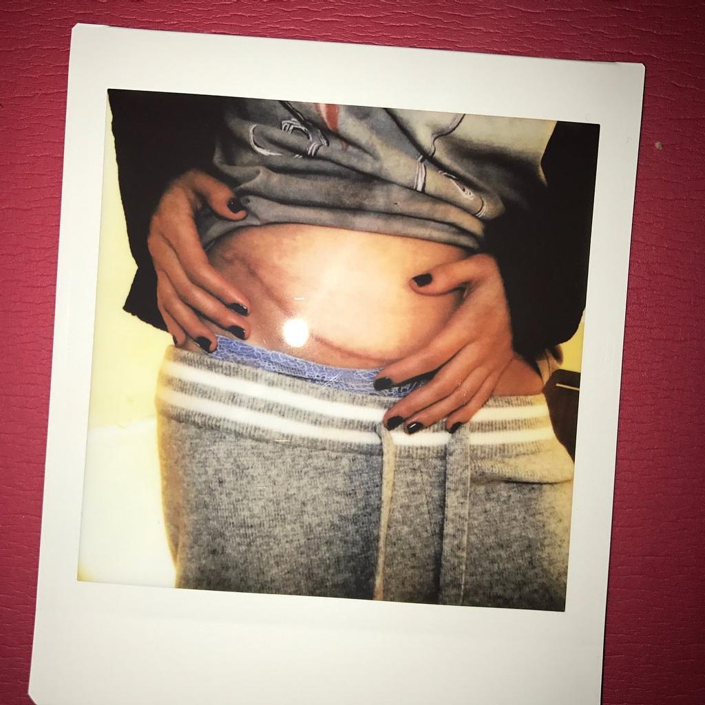 La cicatriz de Selena Gomez