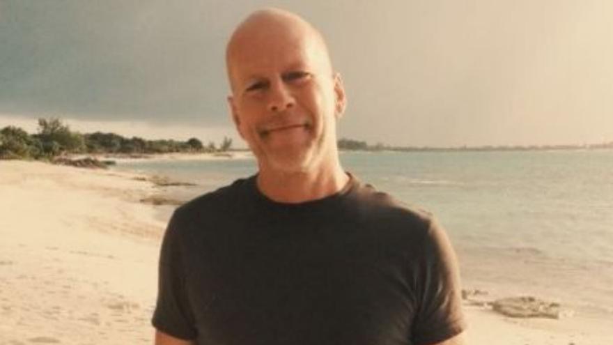 ¿Qué es la demencia frontotemporal que han diagnosticado a Bruce Willis?